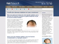Hair Palace : greffe de cheveux sans cicatrices !