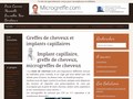 Microgreffe : implants capillaires 